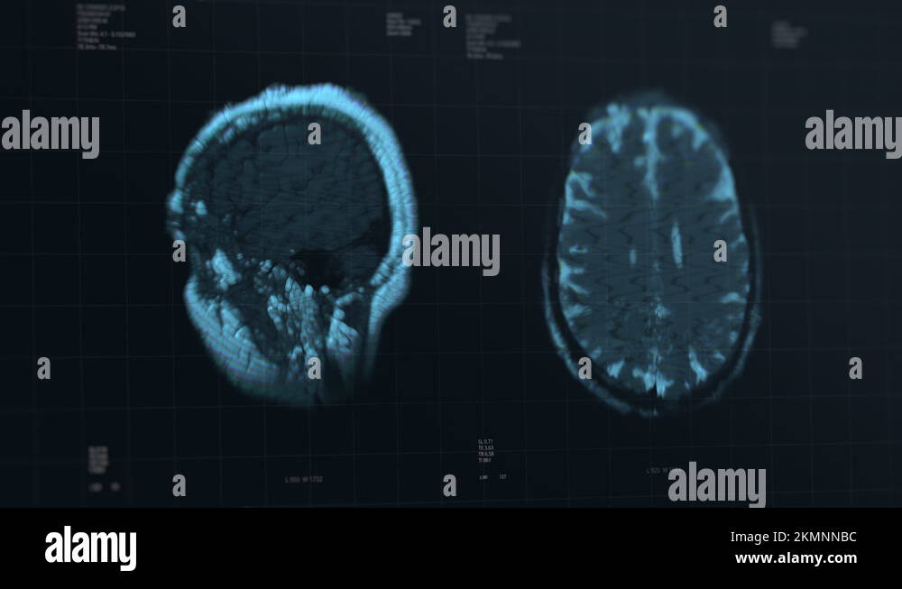 Brain data visualization Stock Videos & Footage - HD and 4K Video Clips ...
