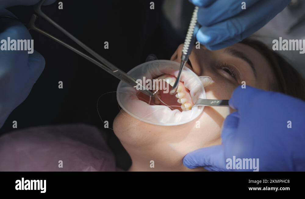 Face of patient, hands of dentist sutured wound after tooth extraction