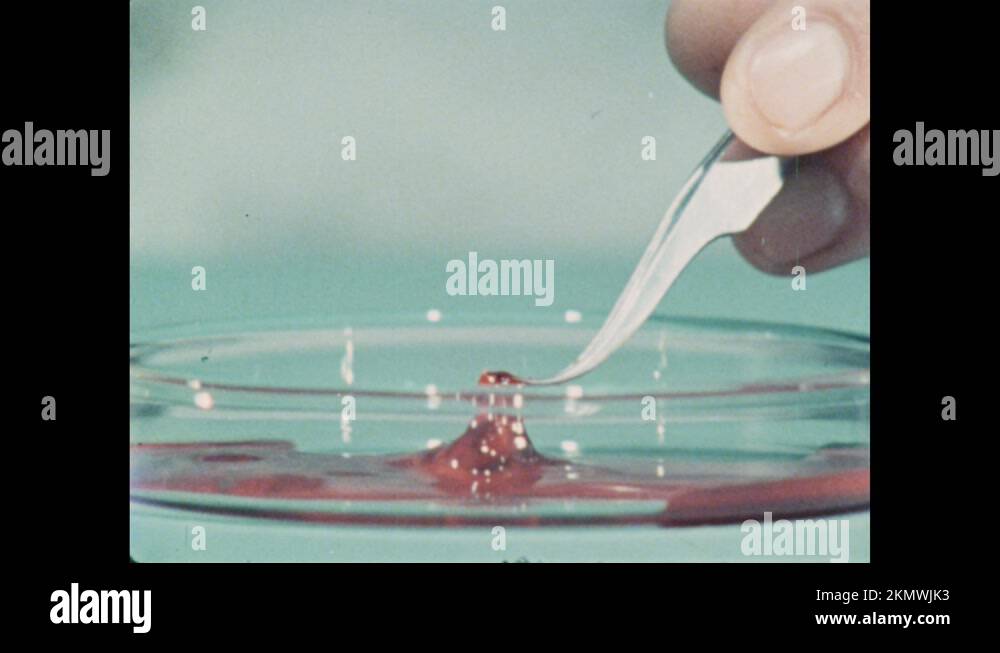 Blood clot test Stock Videos & Footage HD and 4K Video Clips Alamy