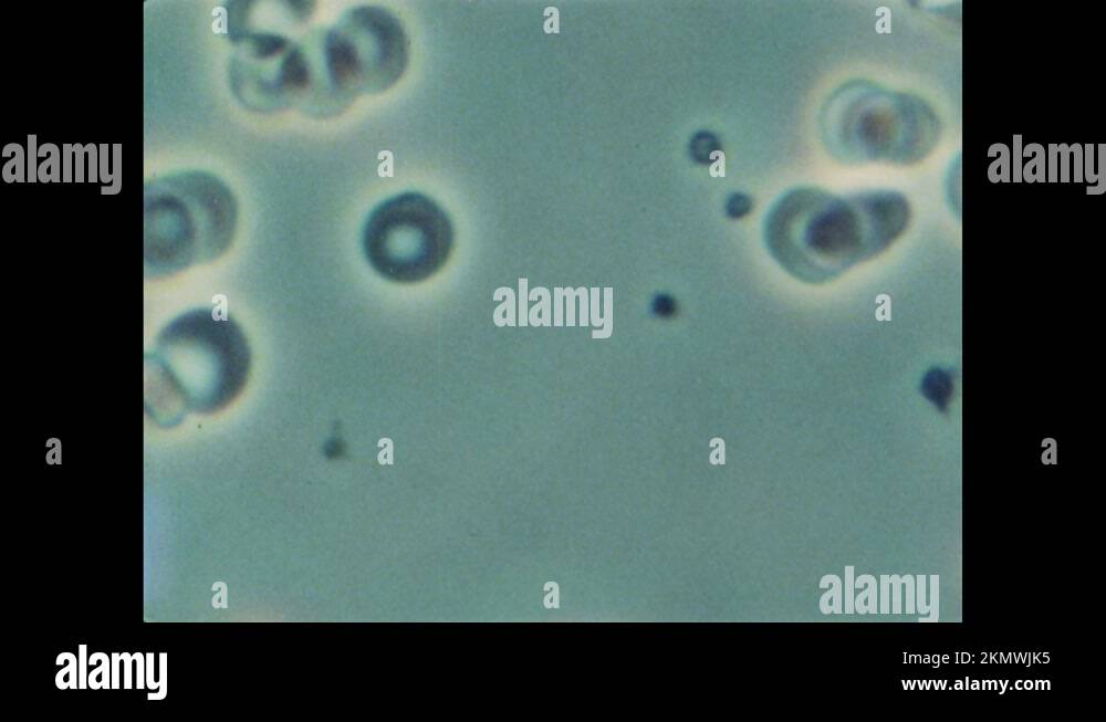 Blood Float 1970s: Blood flows in veins. Platelets and red blood cells float in ...