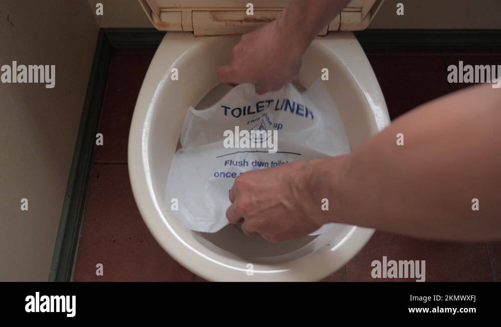 Bowel cancer test Stock Videos & Footage HD and 4K Video Clips Alamy