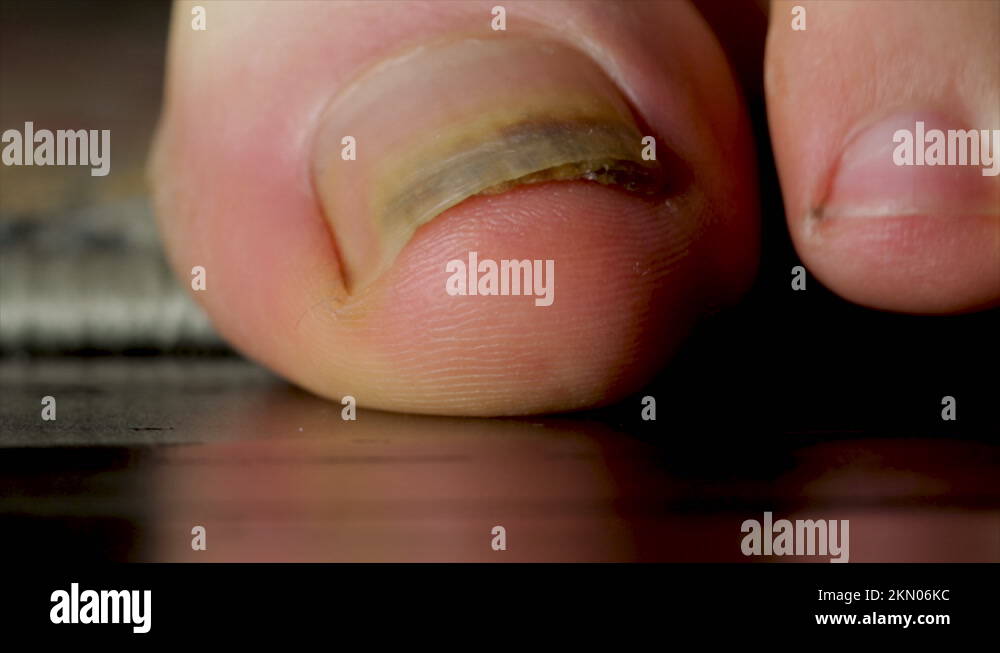 Thicknail Stock Videos & Footage HD and 4K Video Clips Alamy