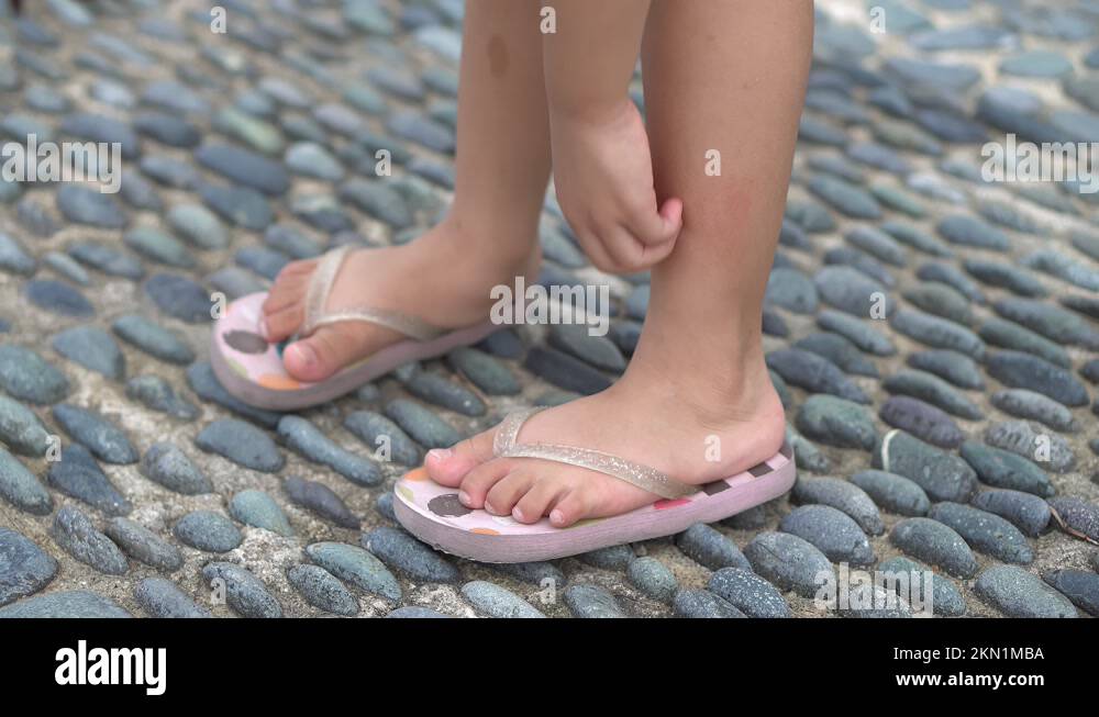 Little girl scratch foot due to itchy Stock Video Footage Alamy