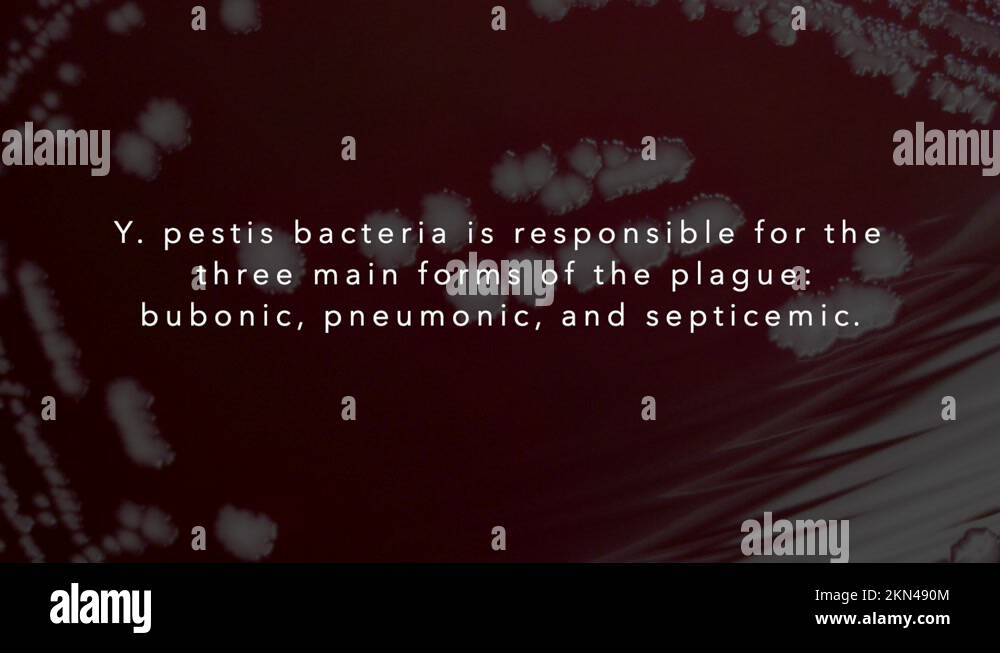 Causative agent plague stock videos footage hd and 4k video clips