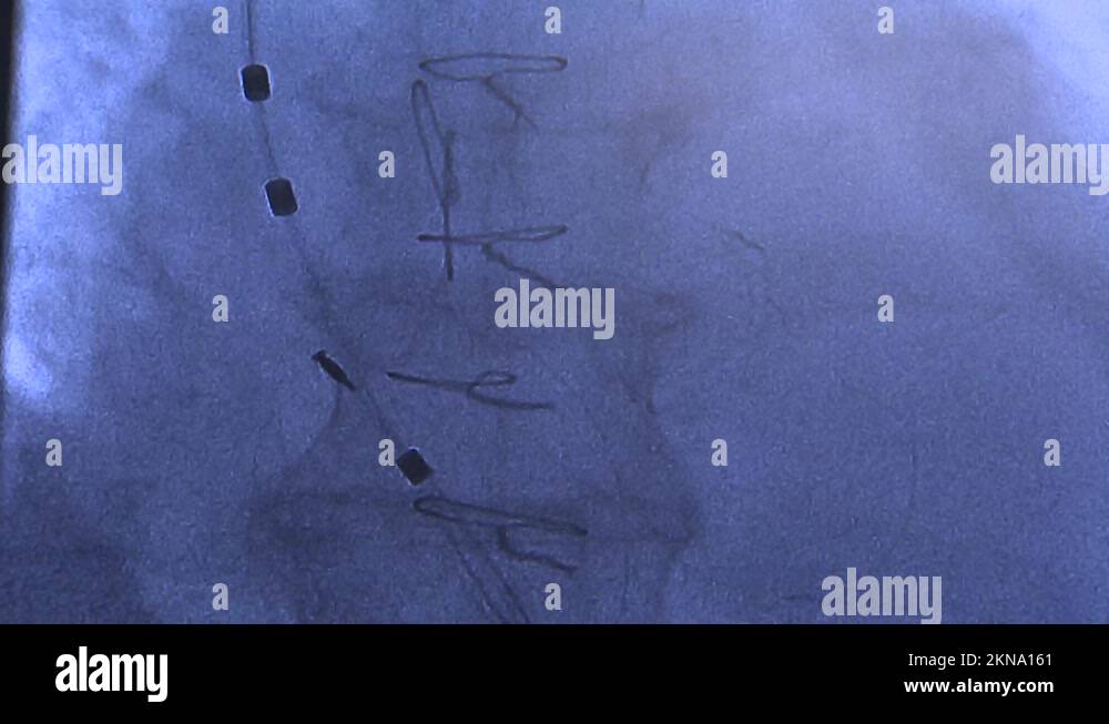 Applying stitches Stock Videos & Footage - HD and 4K Video Clips - Alamy
