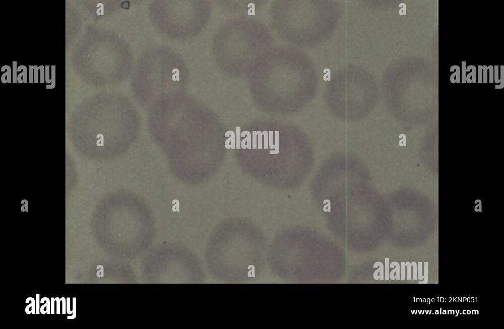 1960s Microscopic image of normal red blood cell highlighted