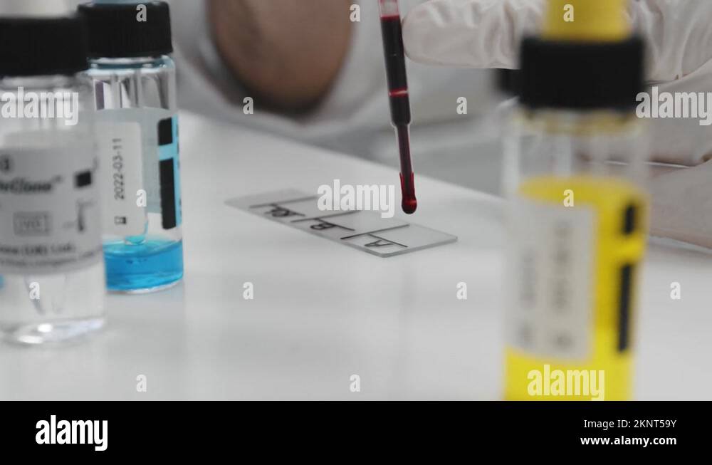 Chemist dropping blood on index card for blood type test in a chemical