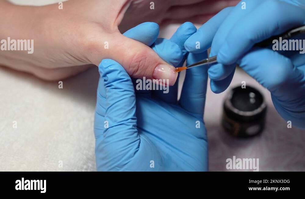 Process of strengthening and correction of natural nails with gel