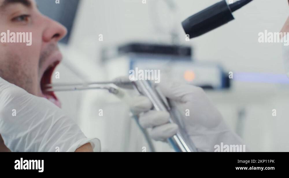 Examination of the larynx of a male patient with the help of medical instruments Stock Video