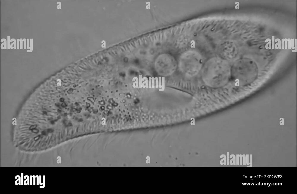 Eating Paramecium Stock Videos Footage Hd And 4k Video Clips Alamy Eating Paramecium Stock Videos Footage Hd And 4k Video Clips Alamy