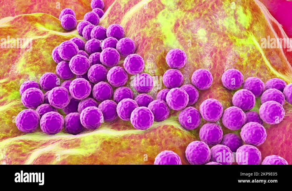 Staphylococcus aureus antibiotics Stock Videos & Footage - HD and 4K ...