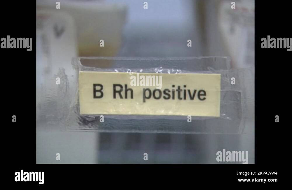 Specimen refrigerator Stock Videos & Footage HD and 4K Video Clips