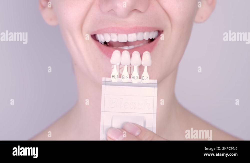 Perfect white teeth close up with shade guide bleach color, female