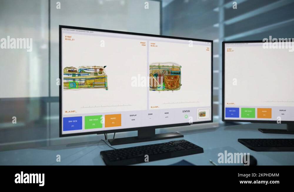 Xray of bag Stock Videos & Footage - HD and 4K Video Clips - Alamy