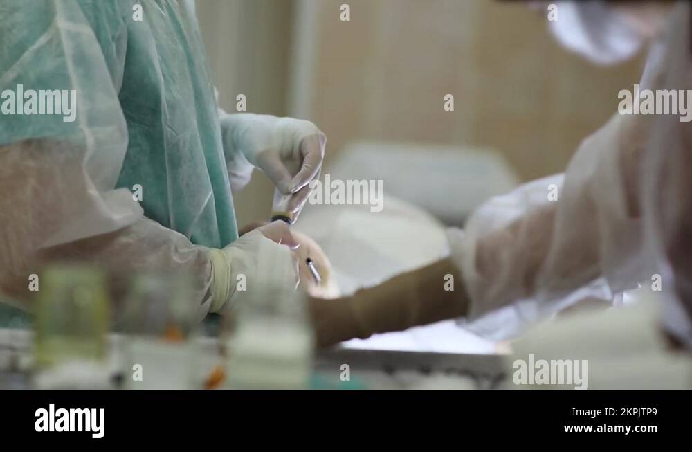 surgical operation lipofilling, liposuction syringes with adipose tissue stem Stock Video