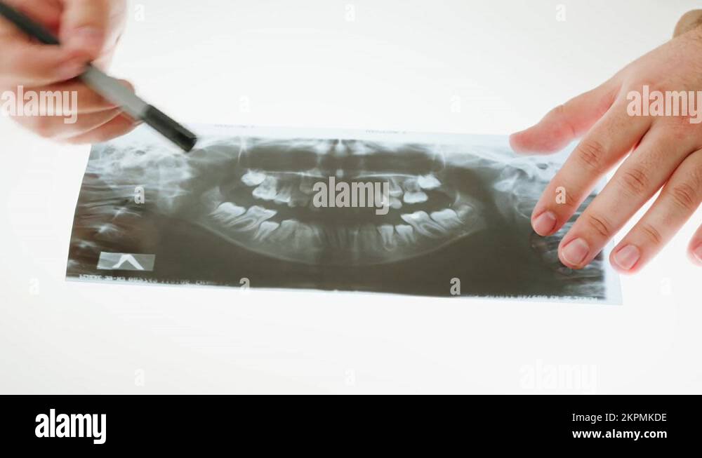 Jaw xray closeup. Resonance Image of theeth. Doctor