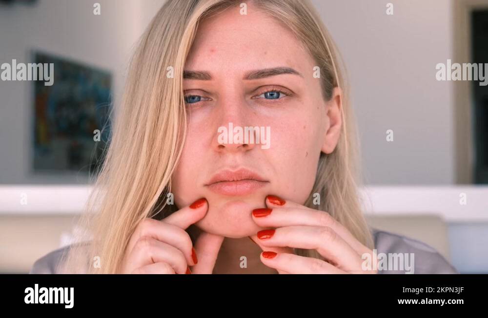 Second chin, obesity. A portrait of a 30yearold woman pulling back