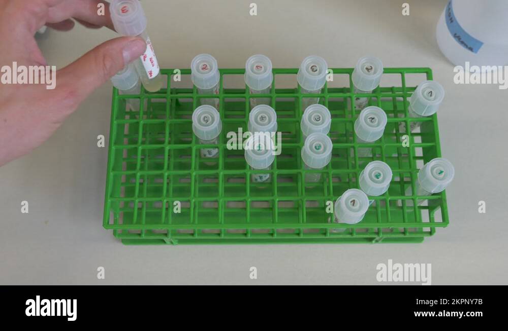 Sample holder Stock Videos & Footage HD and 4K Video Clips Alamy