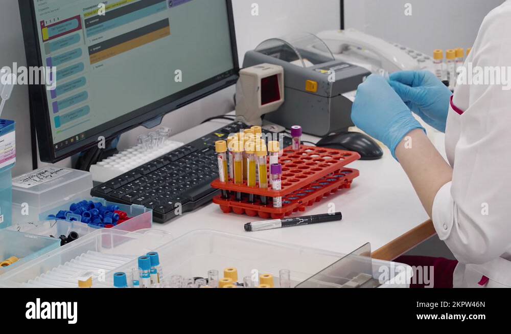 Collected blood samples Stock Videos & Footage HD and 4K Video Clips