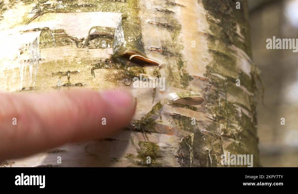 Birch tree leaking sap from a wound in a forest while being touch Stock