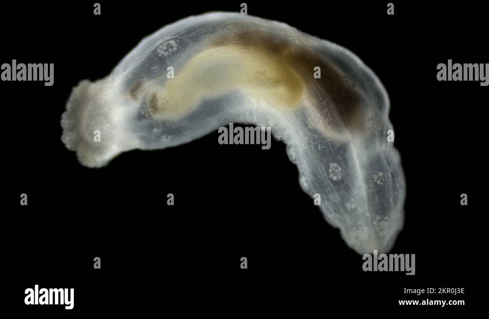 Sea cucumber Chirodota under a microscope, class Holothuroidea, order