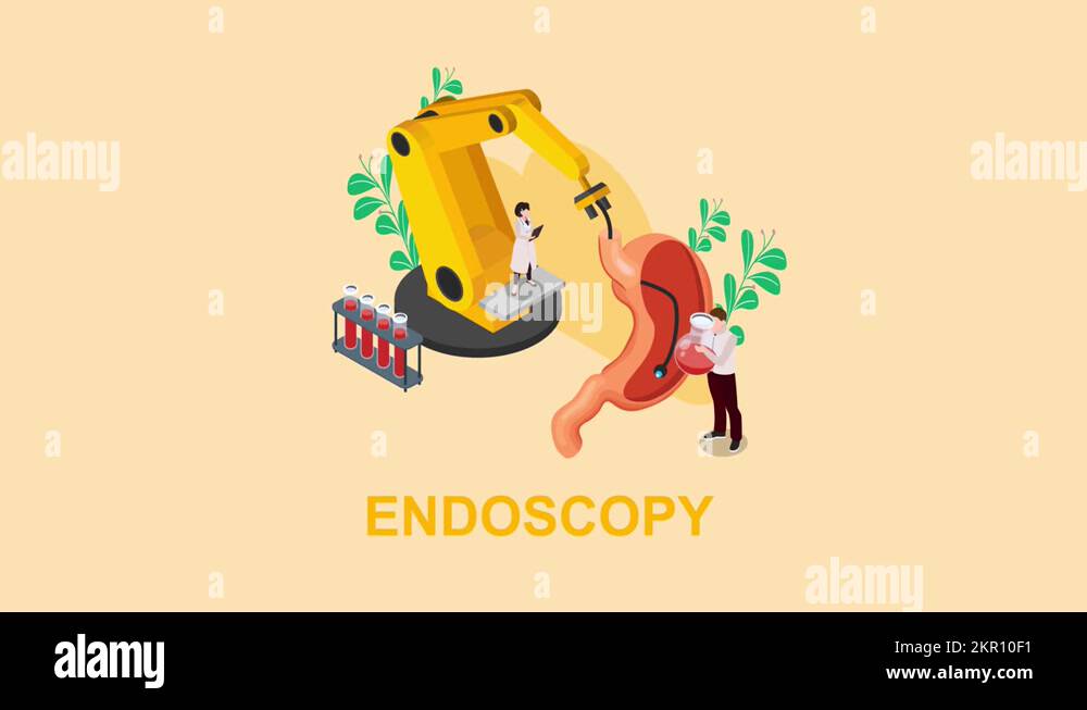 Endoscopy esophagus stomach Stock Videos & Footage HD and 4K Video