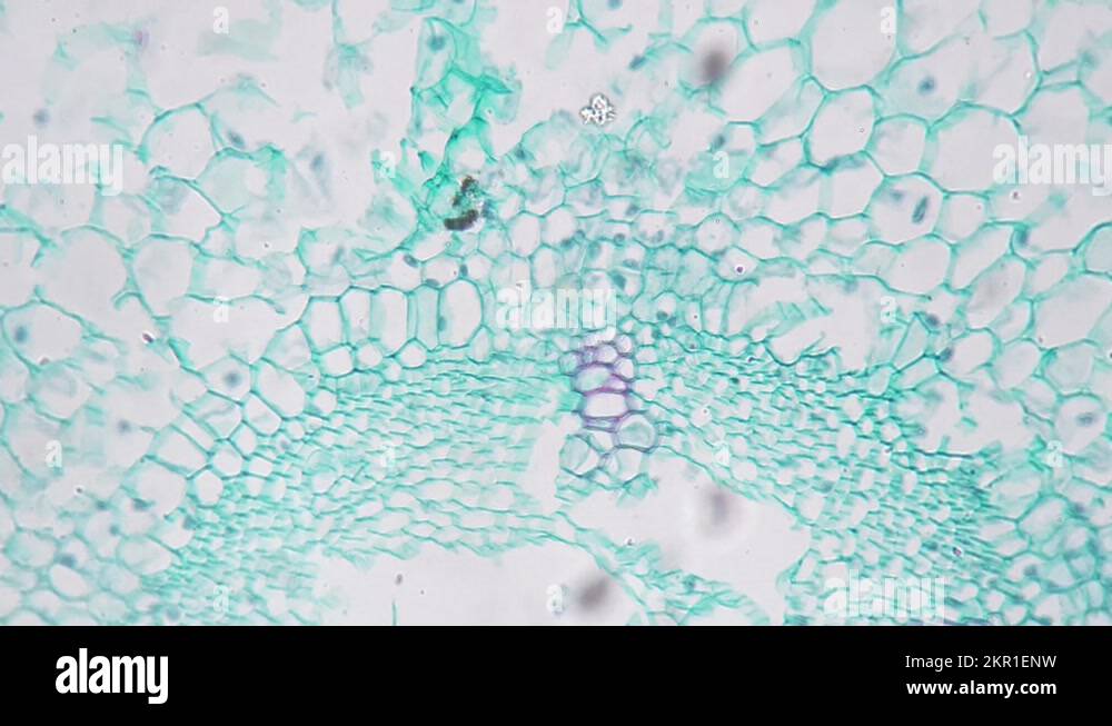 Lateral Roots Microscope Young root of a plant in transversal section seen through microscope ...