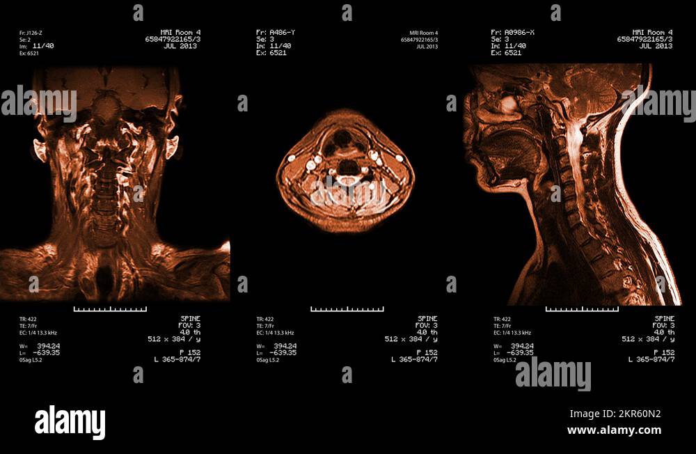 Mri neck Stock Videos & Footage - HD and 4K Video Clips - Alamy