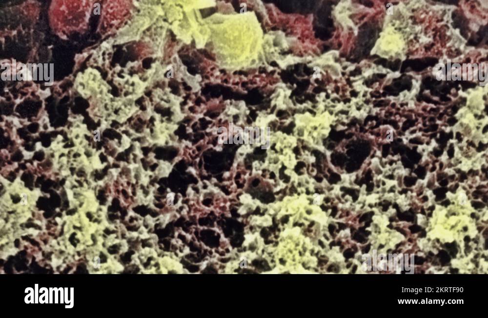Layers of the retina Stock Videos & Footage - HD and 4K Video Clips - Alamy