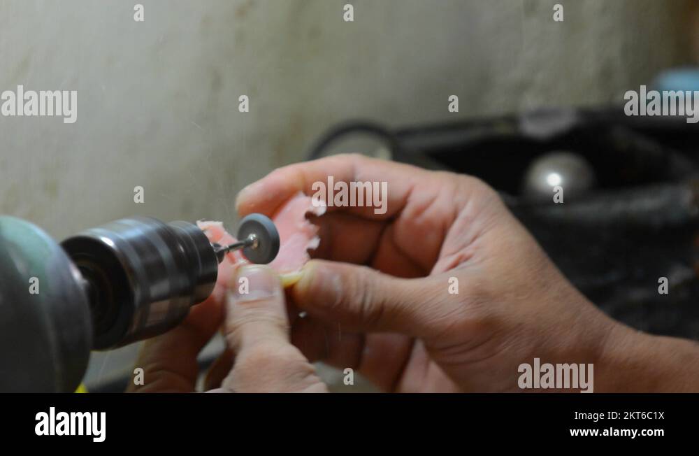 Making dentures in the Republic of the Philippines Stock Video Footage
