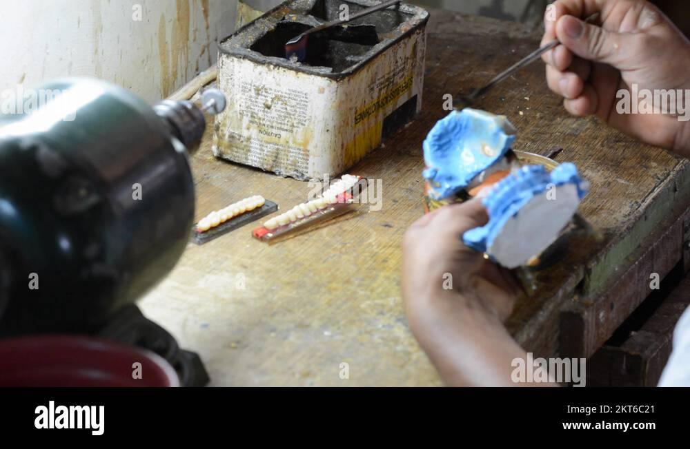 Making dentures in the Republic of the Philippines Stock Video Footage