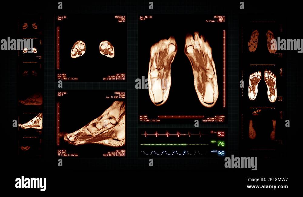 Foot MRI Scan. Amber. 3 in 1. Top, front, lateral view and ECG display