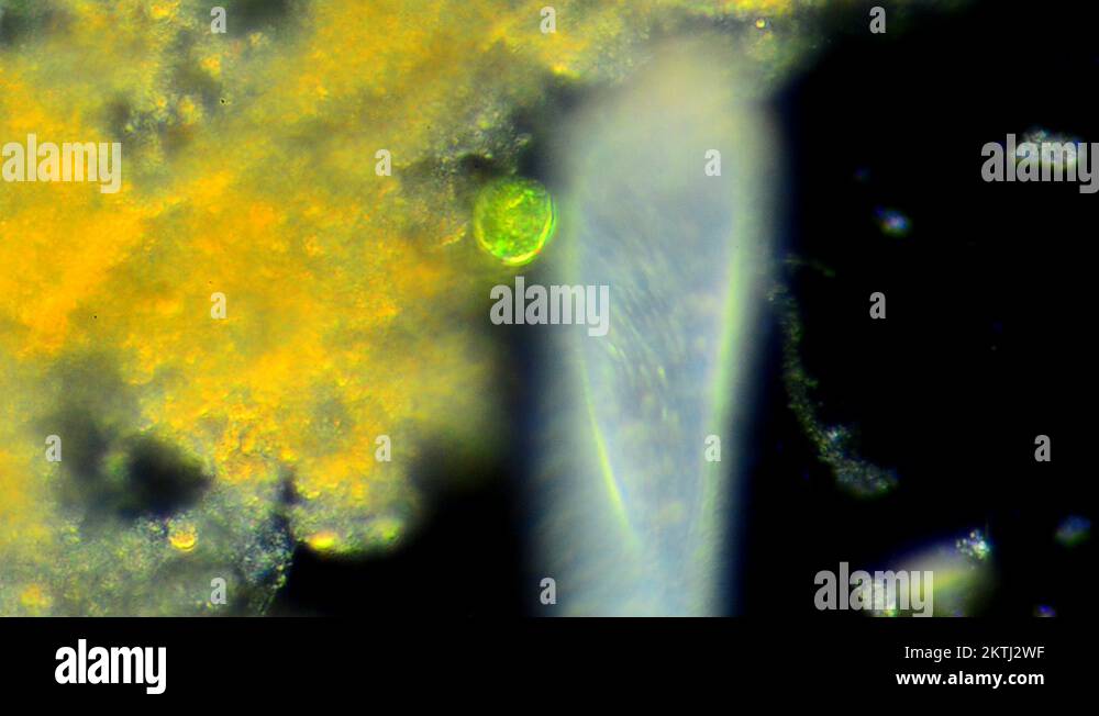 Paramecium Stock Videos Footage Hd And 4k Video Clips Alamy Paramecium Stock Videos Footage Hd And 4k Video Clips Alamy