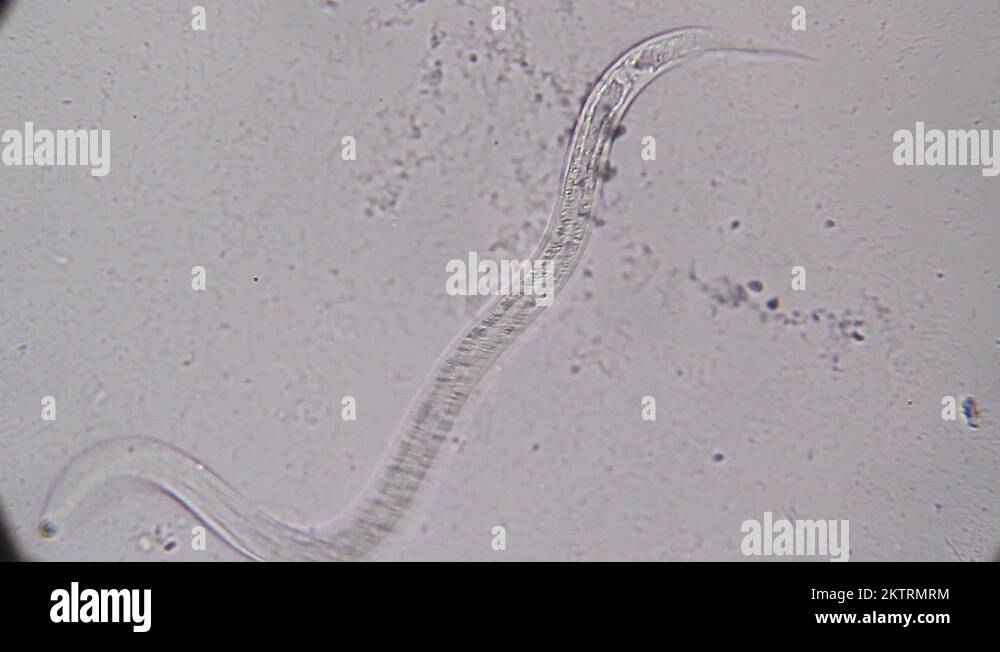 Vinegar Eels (Turbatrix aceti ,Vinegar nematode Stock Video Footage Alamy