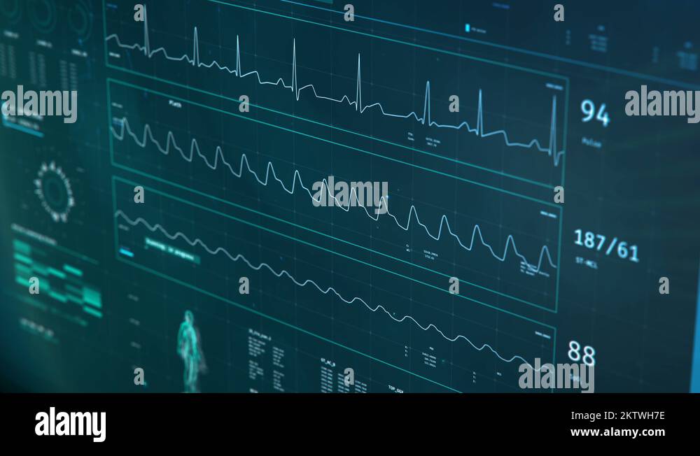 Modern ICU monitor in expensive clinic, patients vital signs monitored ...