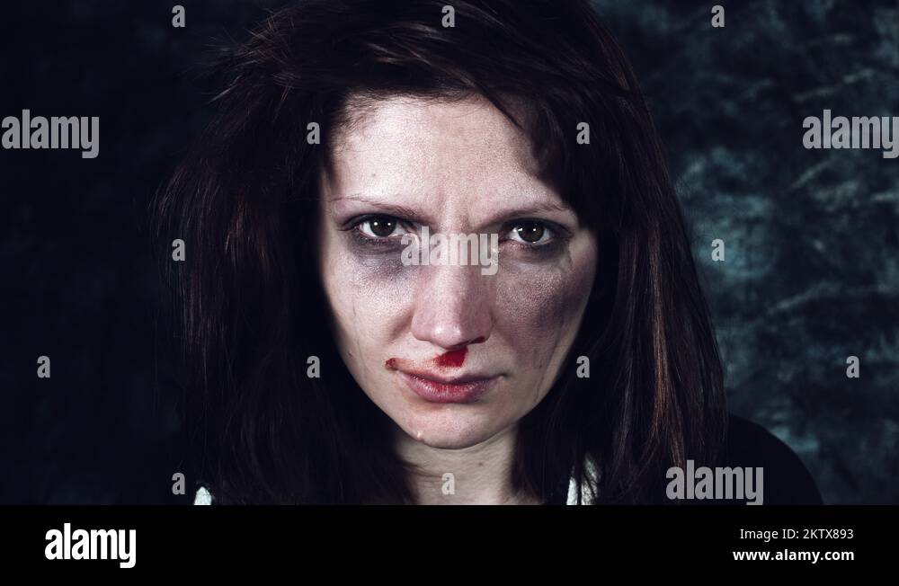 4k Domestic Violence and Abuse, Woman with Bruises Crying and Looking