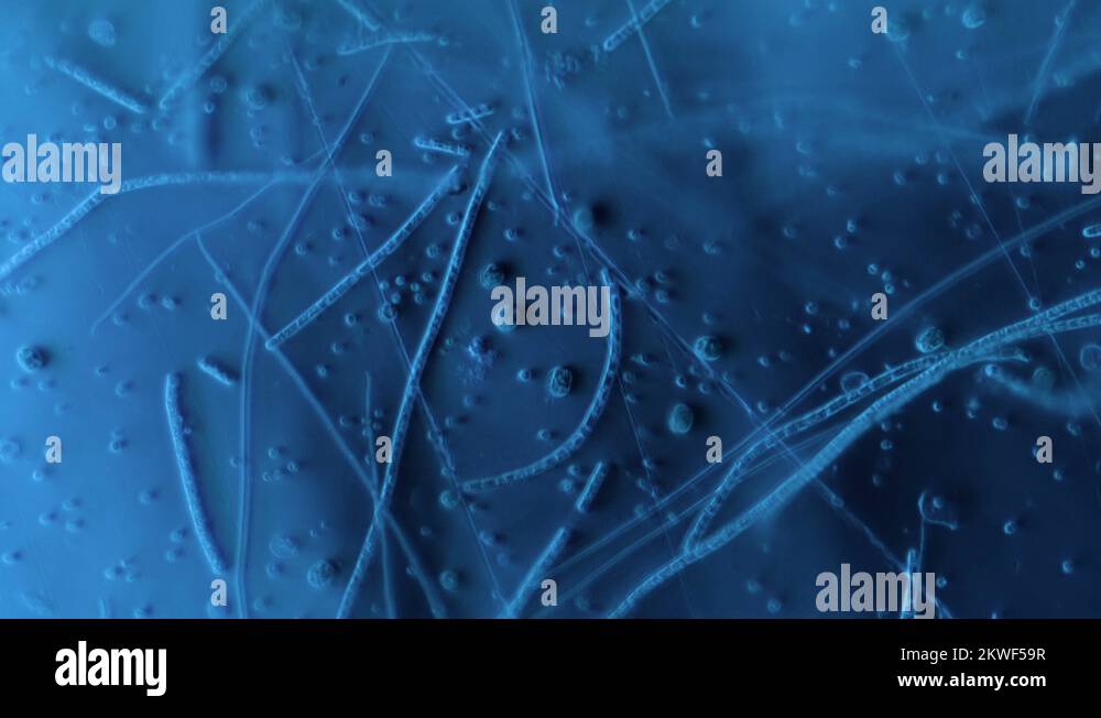 Bacteria bed Stock Videos & Footage HD and 4K Video Clips Alamy