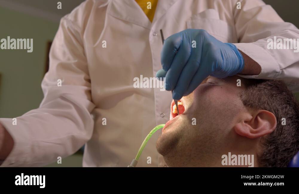 Dentist Water Rinses The Oral Cavity of The Patient After Removal of Tartar With Stock Video