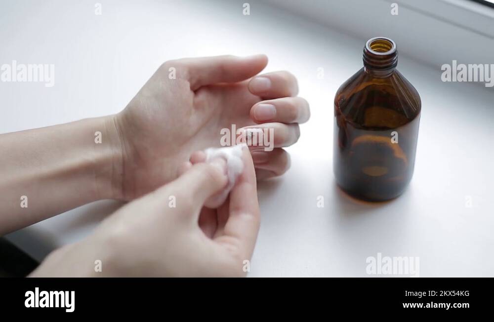 Horrible trauma of fingernail. Subungual hematoma. Bruise under the ...