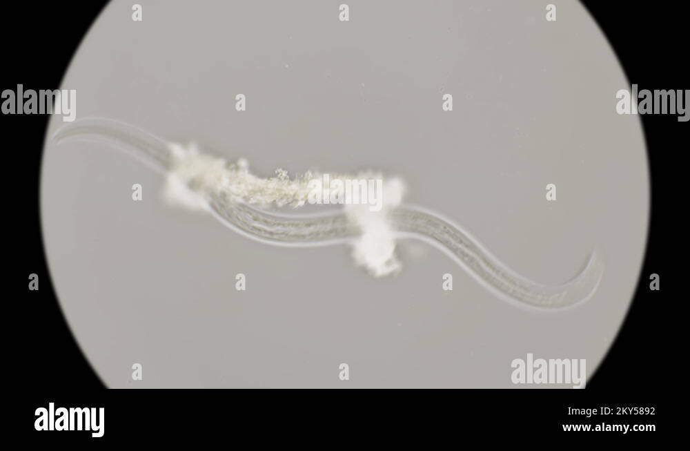 The Nematode Worm Under A Microscope Stock Video Footage Alamy 9757