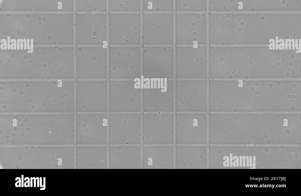 Counting blood cells in the Goriaev chamber under a microscope Stock