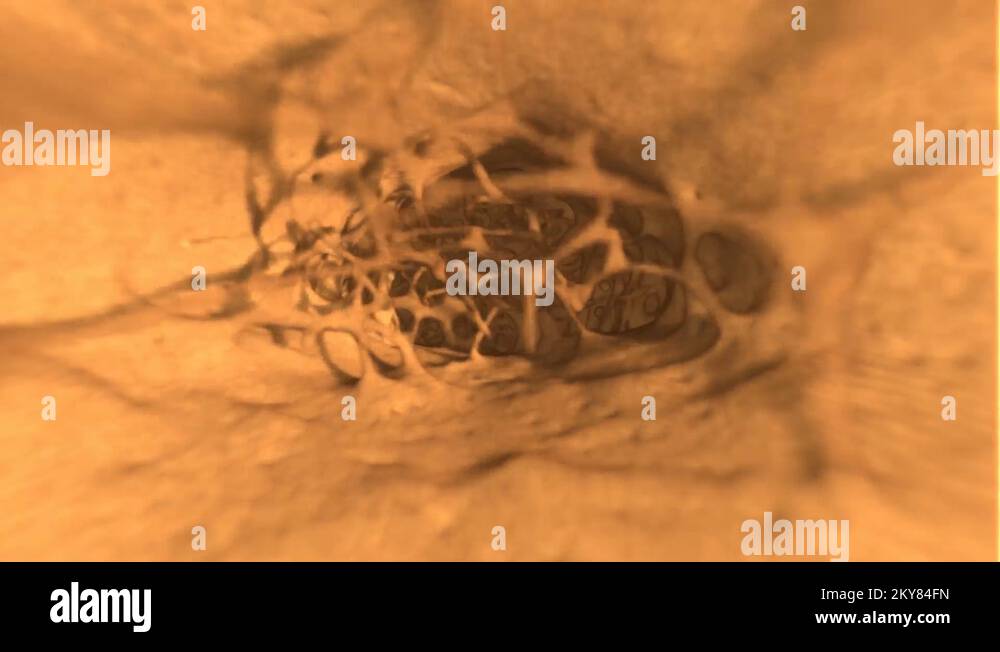 Trabecular Bone Stock Videos Footage Hd And 4k Video Clips Alamy Trabecular Bone Stock Videos Footage Hd And 4k Video Clips Alamy