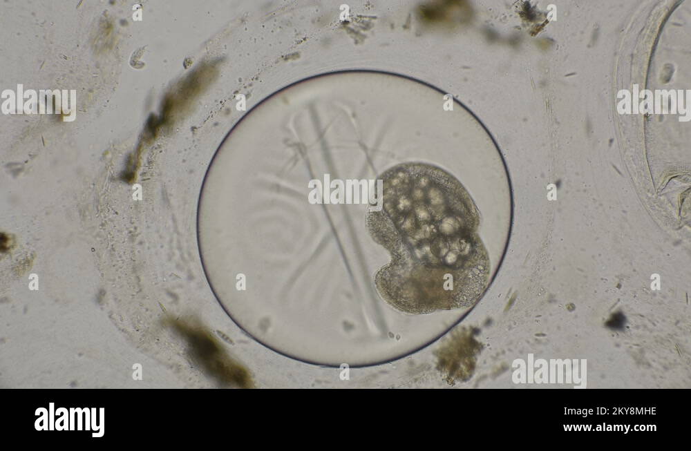 movement of the eggs of the Snail Planorbis under a microscope Stock