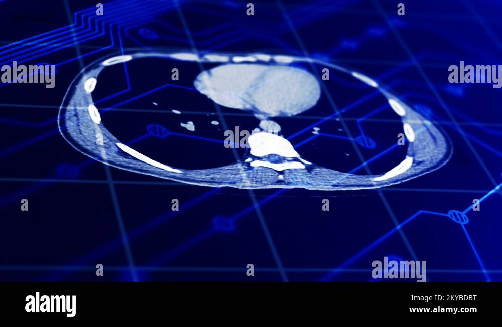MRI and CT technology concept. Scanning process. Xray emitting Stock