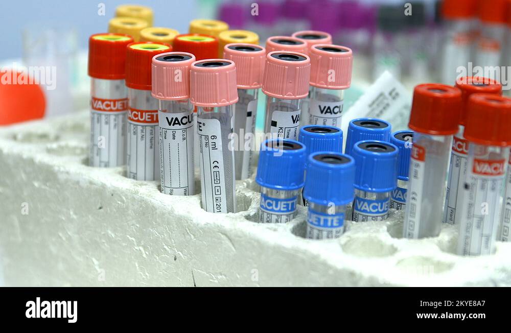 PAN Medical samples in test tubes, panning from left to right Stock