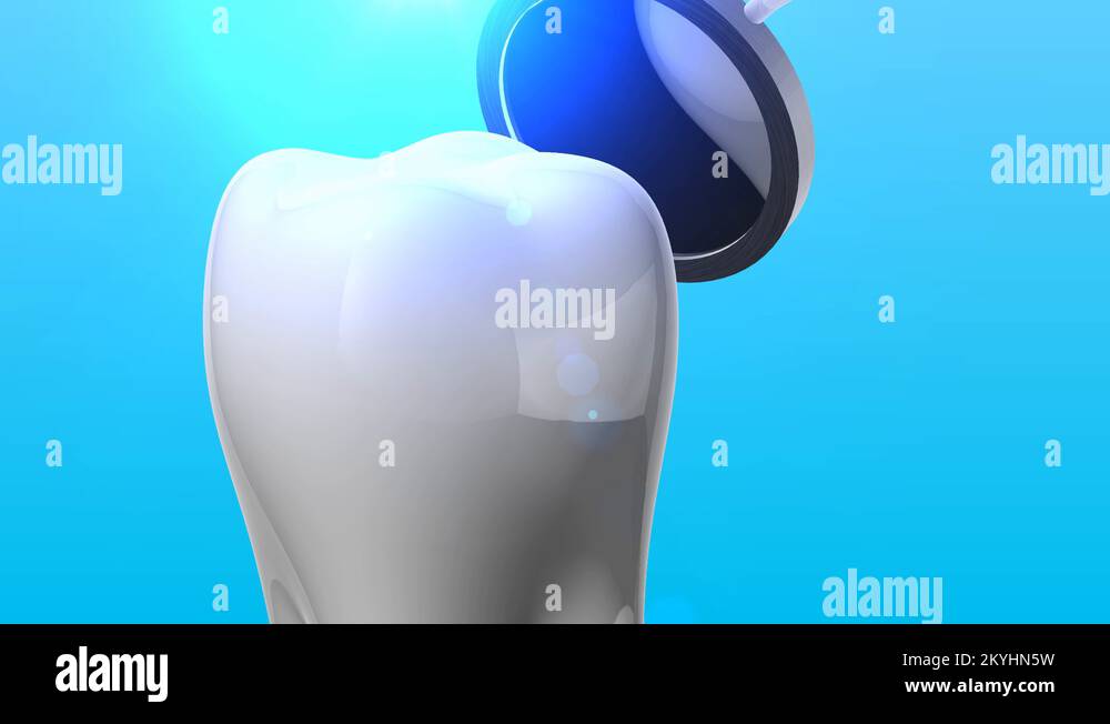 Tooth and dental tool in 3d animation with blue background Stock Video ...