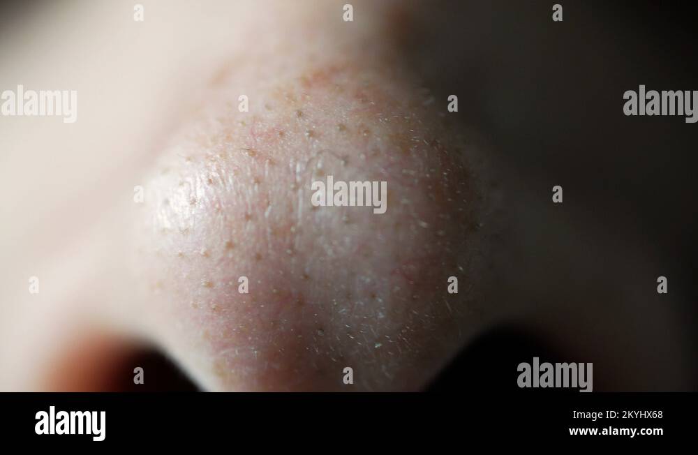 Nostrils human nose Stock Videos & Footage - HD and 4K Video Clips - Alamy