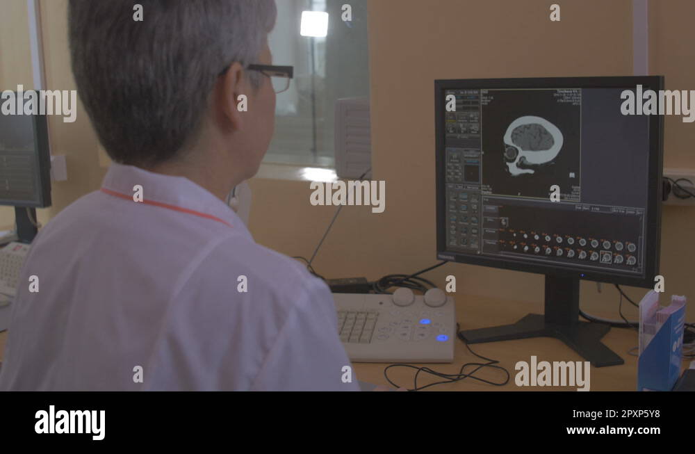 Unrecognizable Doctor examines a head MRI scan on a computer screen ...