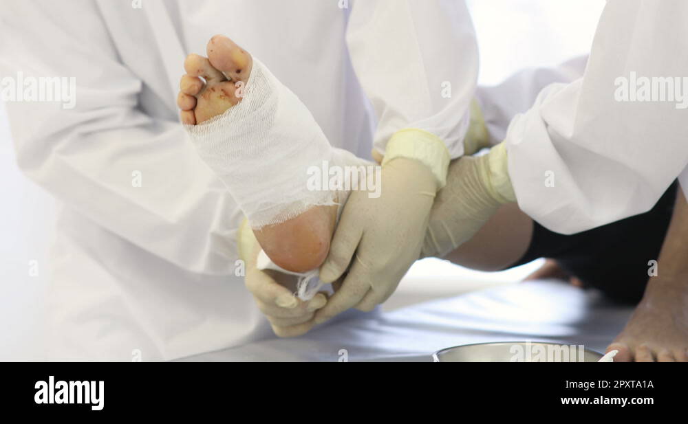 Stitched skin after medical procedure Stock Videos & Footage HD and