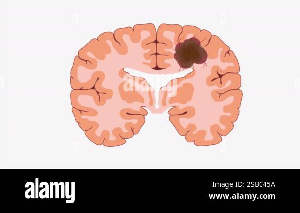 2D Animation showcasing a cross-section of the human brain ...